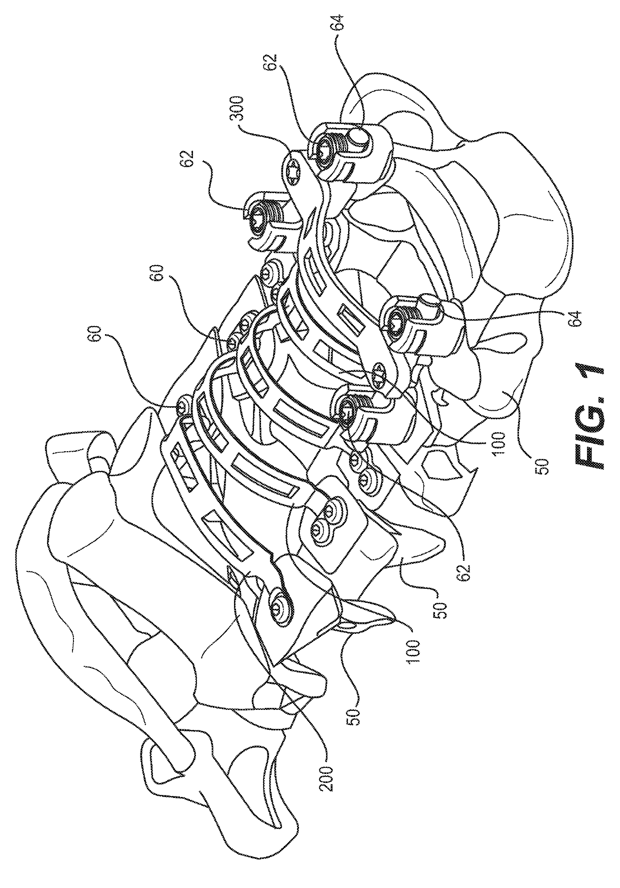 Lamina plate assembly