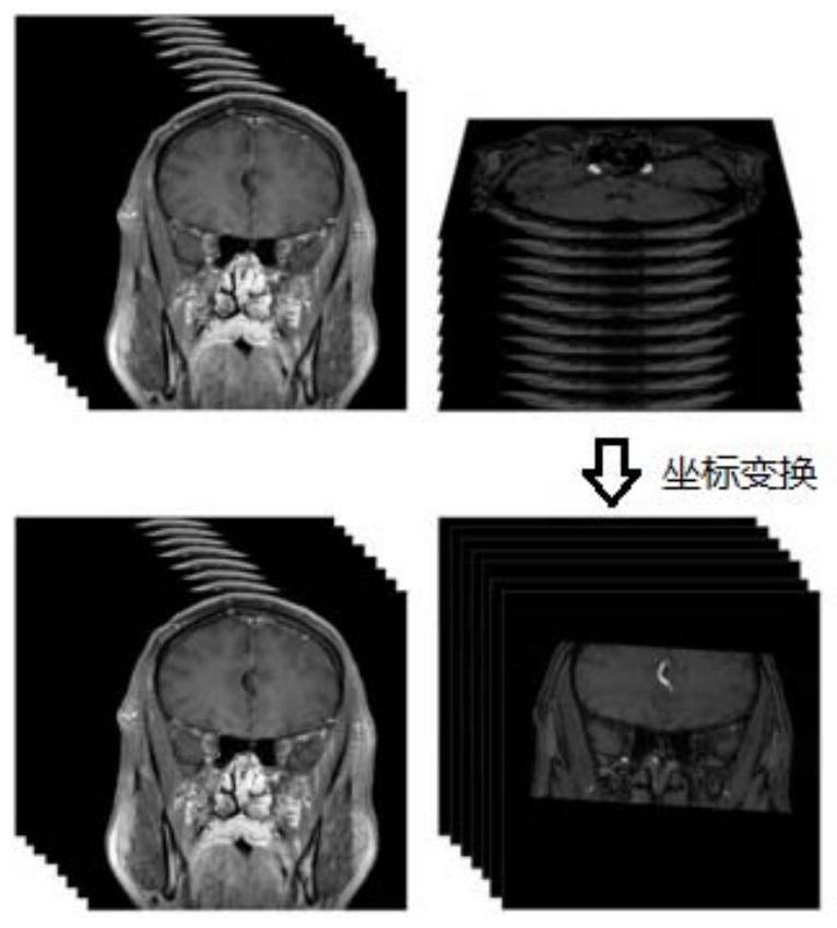 Intracranial blood vessel image registration method