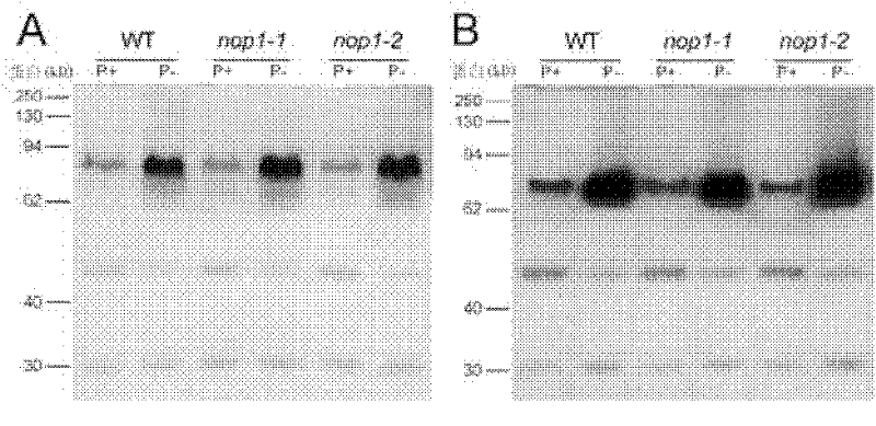 Acidic phosphatase, its encoding gene and application