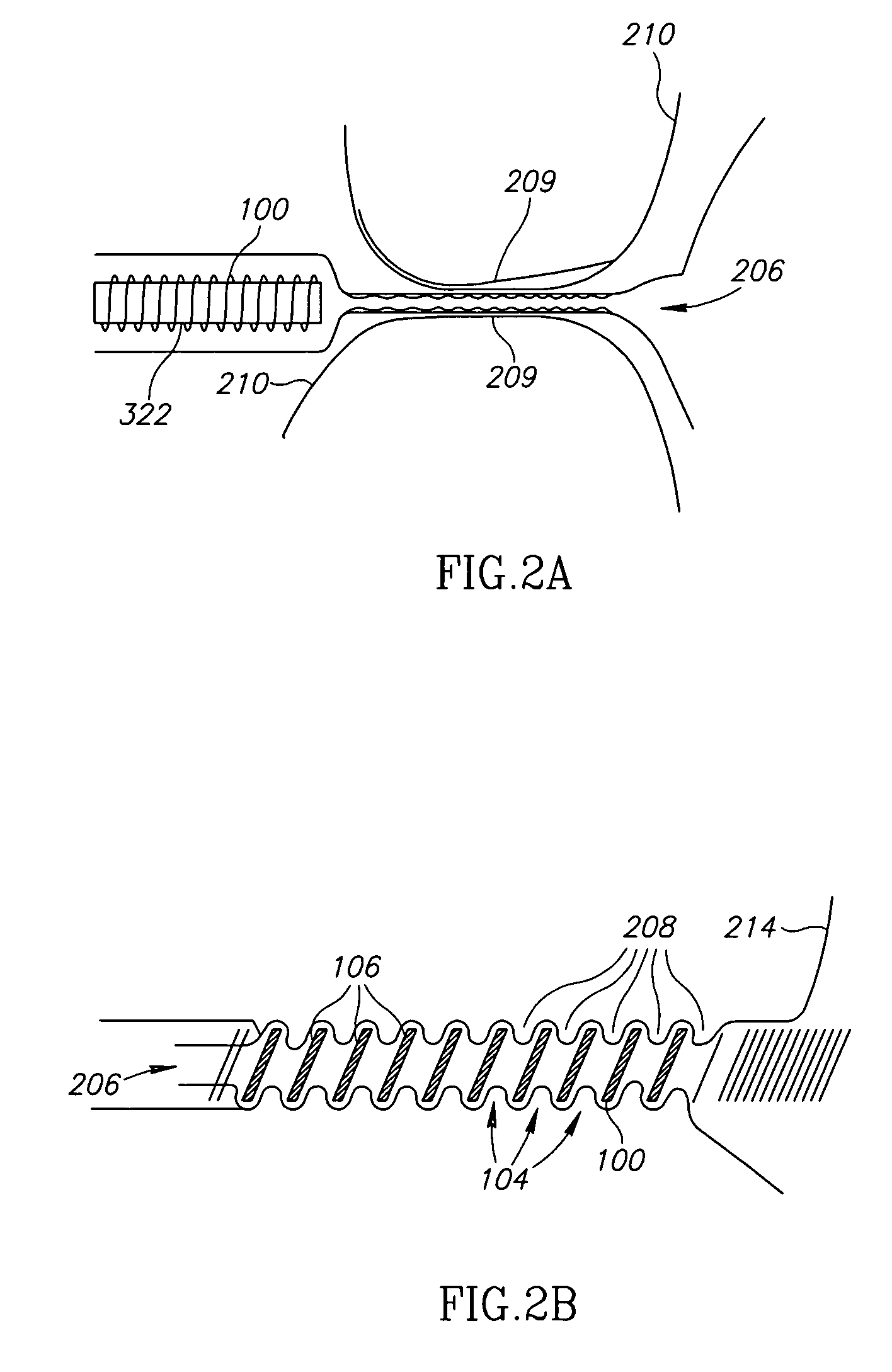 Prostate treatment stent