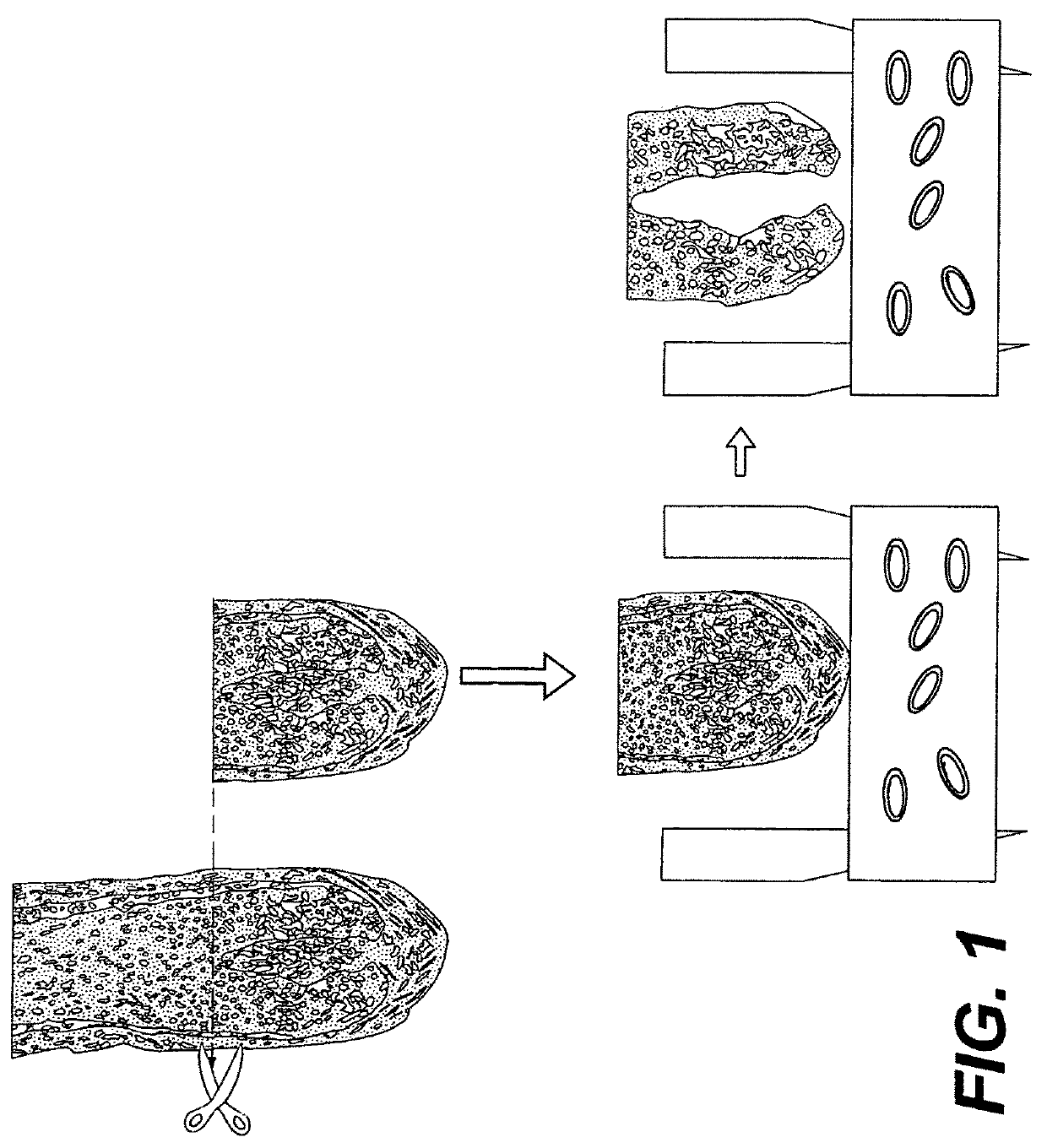 Pigmentable epidermis equivalent prepared from matrix cells and methods for the production thereof