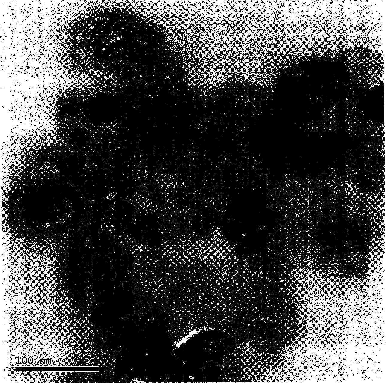 Nanometer hydroxyapatite/chitosan/gelatin porous scaffold material and preparation method thereof