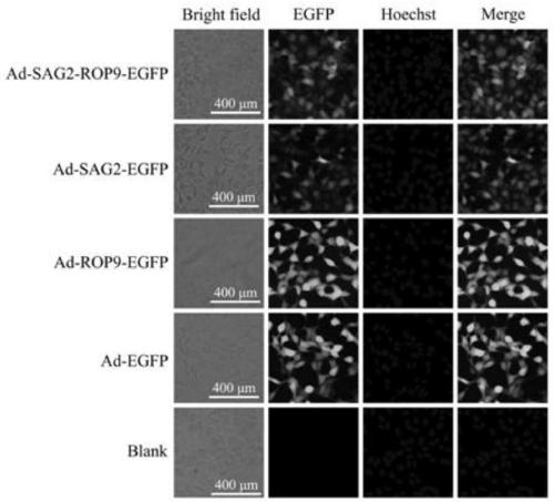 Construction method of toxoplasma gondii SAG2 gene and ROP9 gene recombinant adenovirus, recombinant adenovirus and application