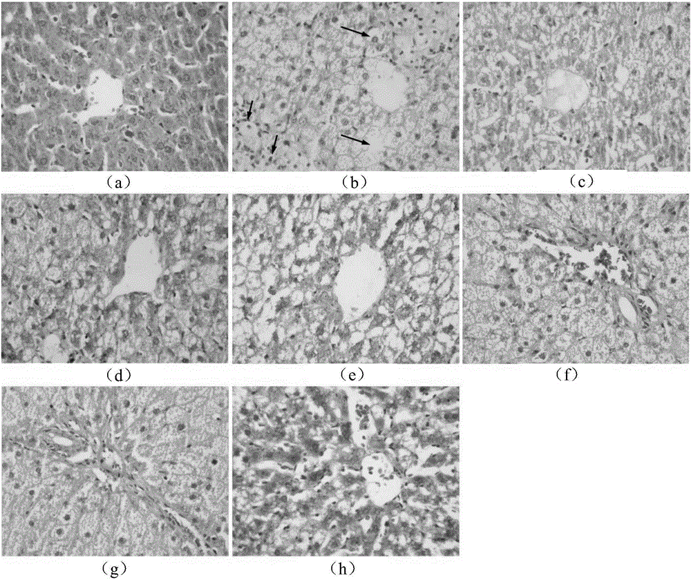 Lotus leaf composition and application thereof