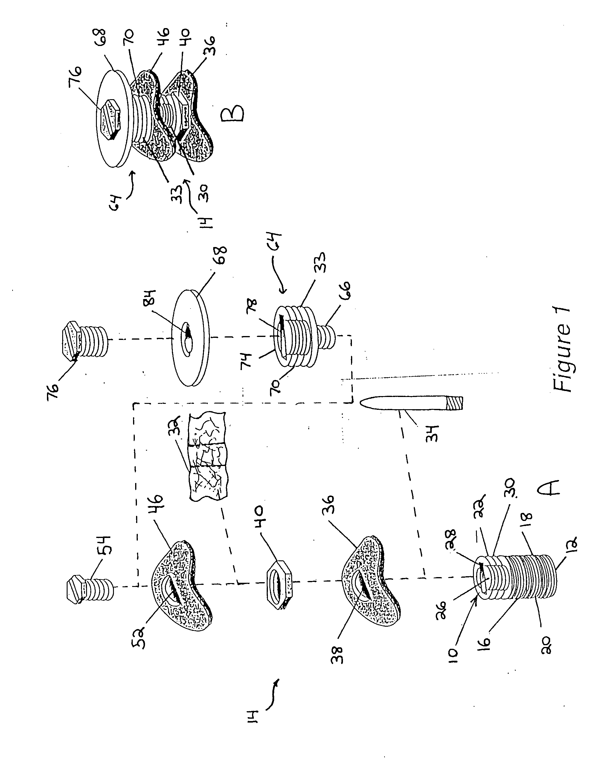 Structural/biological implant system