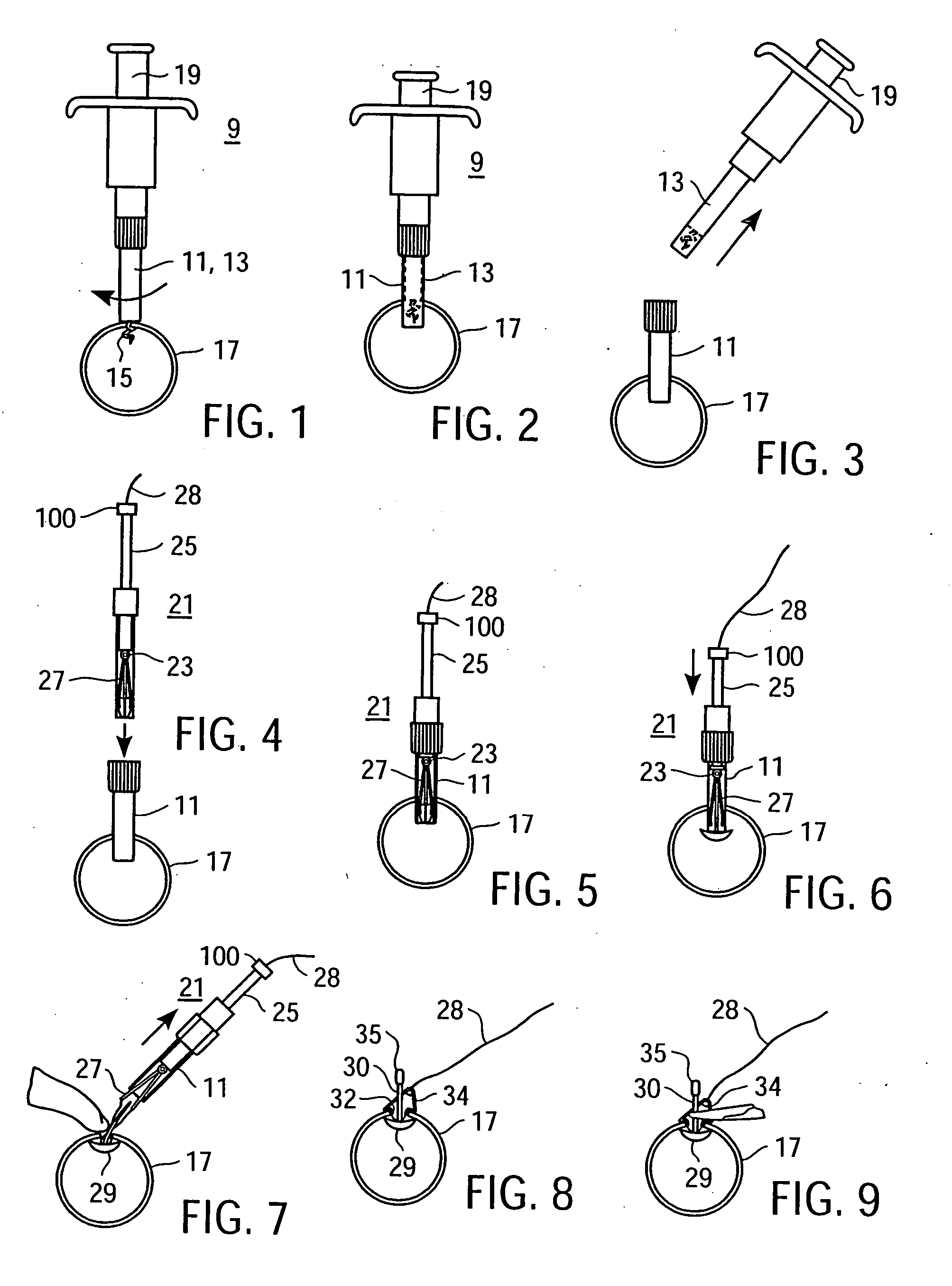 Temporary seal and method for facilitating anastomosis