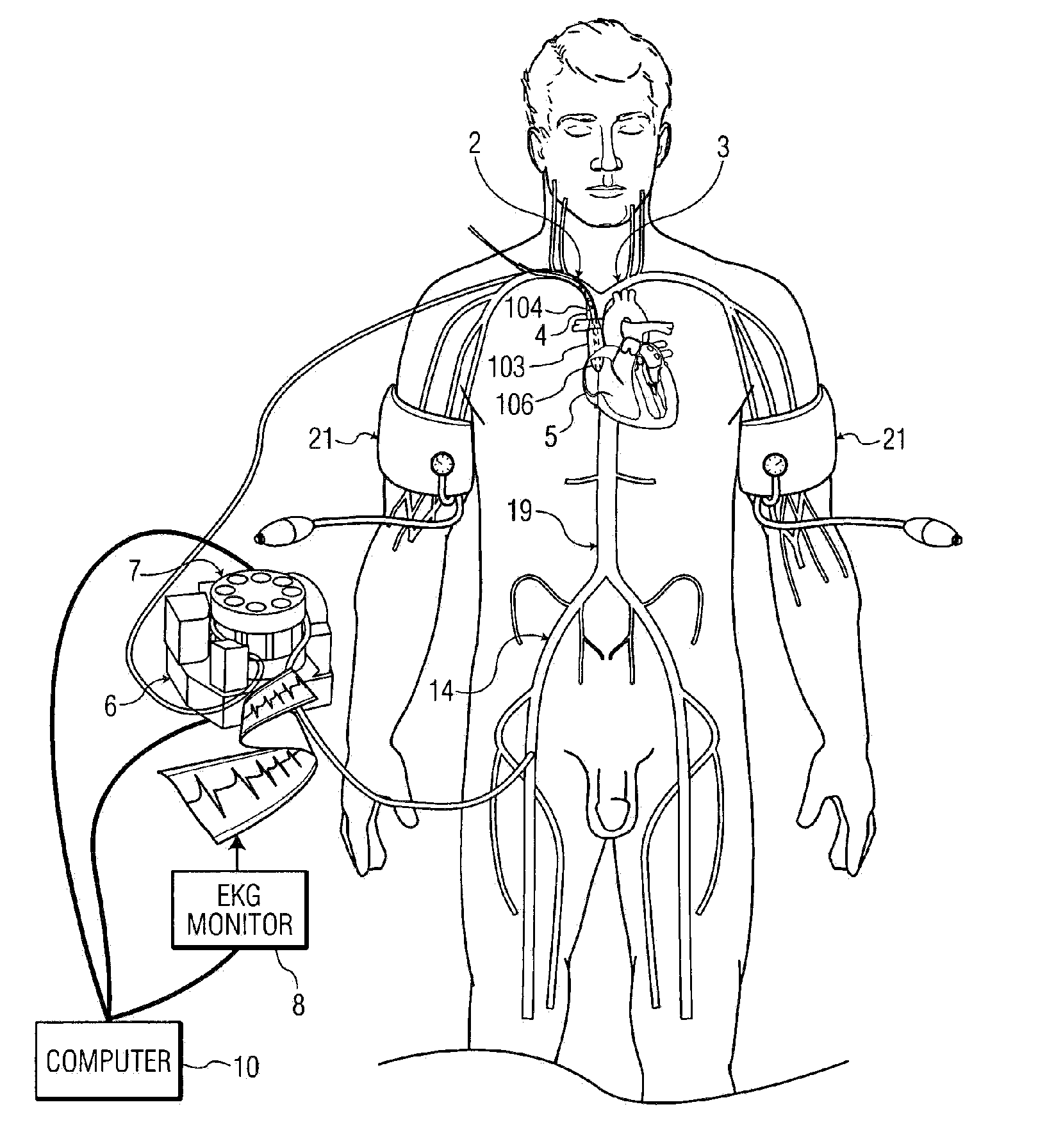 System, Methods and Apparatus for Cerebral Protection