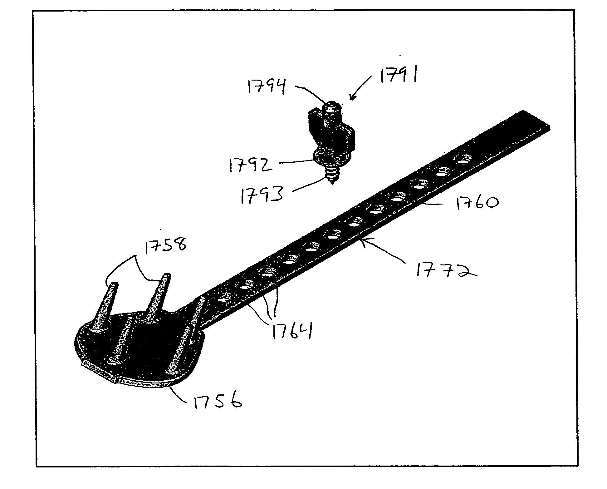 Remotely anchored tissue fixation device and method