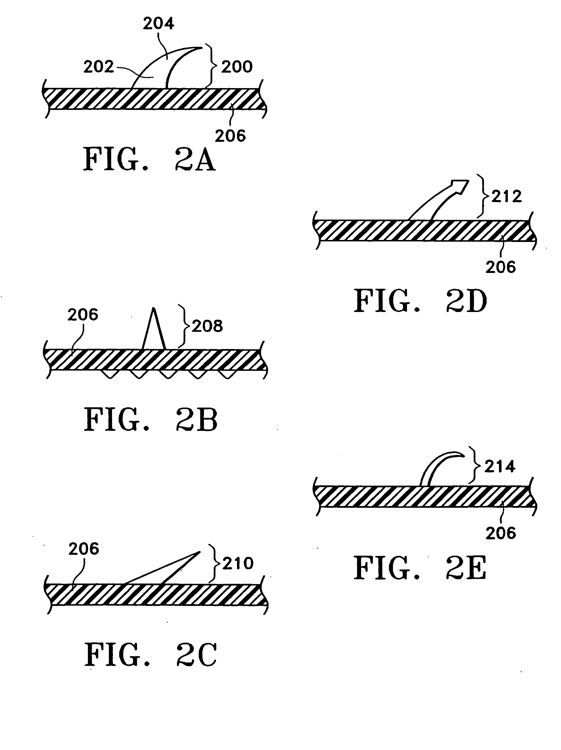 Remotely anchored tissue fixation device and method