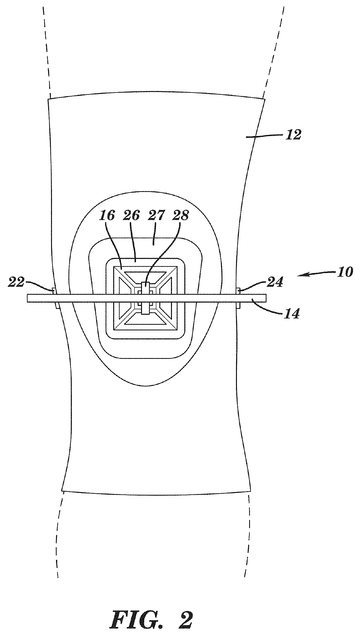 Device for managing patellofemoral pain and methods of use thereof