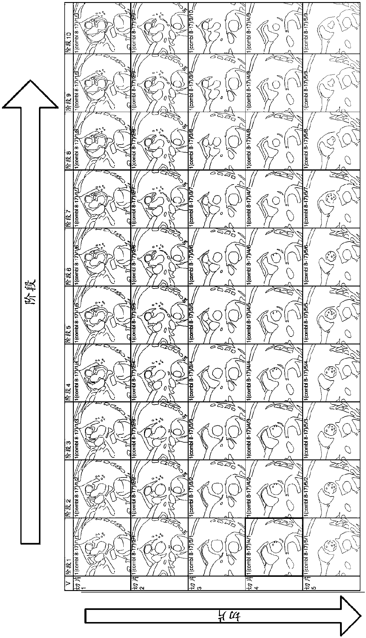 Method and system for analysis of myocardial wall dynamics