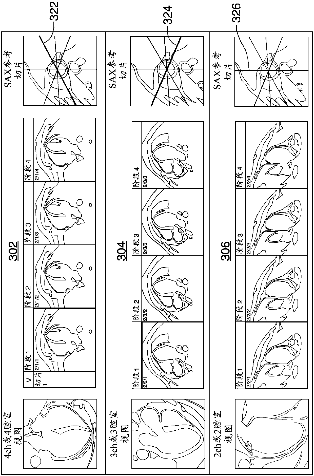 Method and system for analysis of myocardial wall dynamics