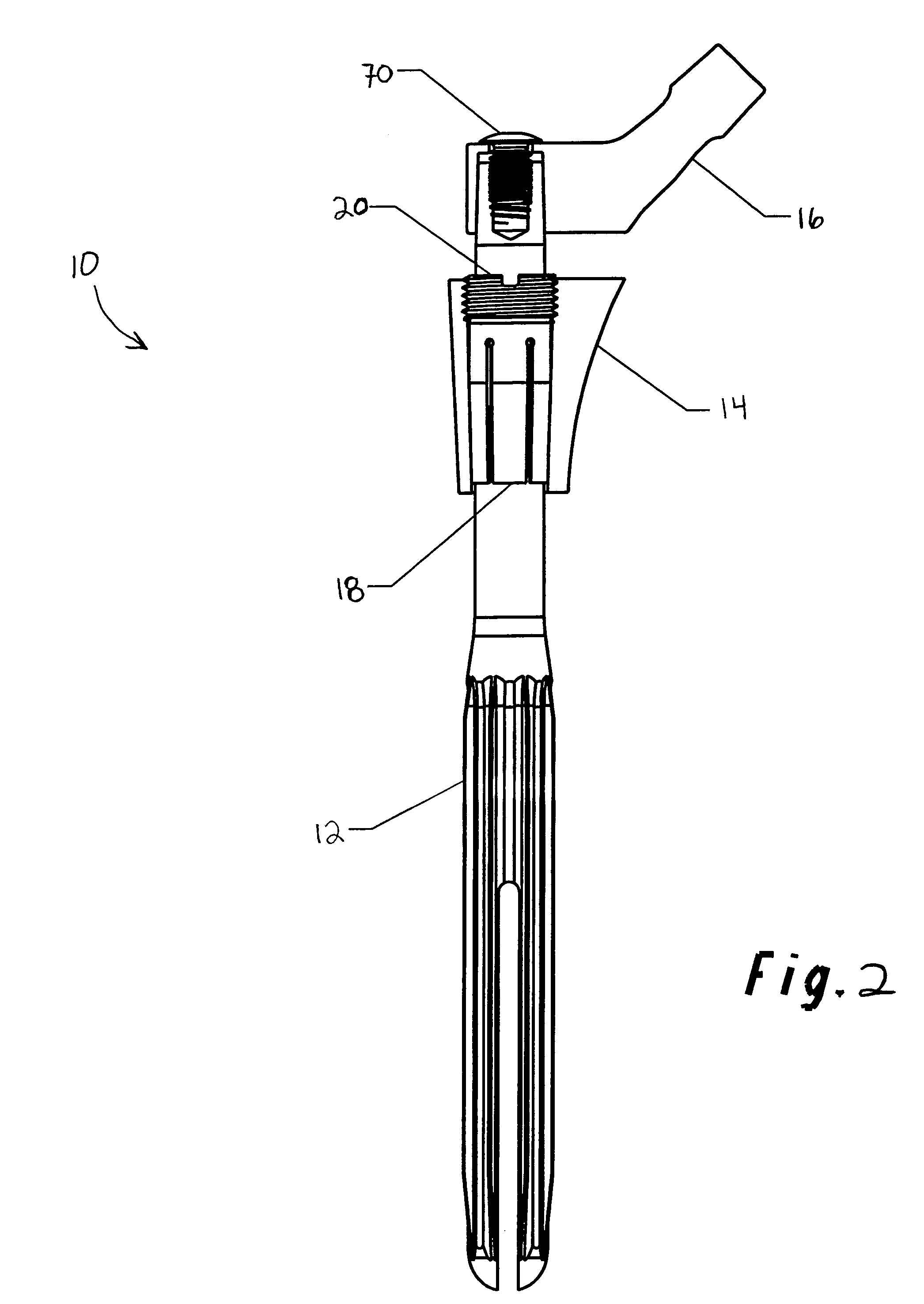 Modular hip prosthesis