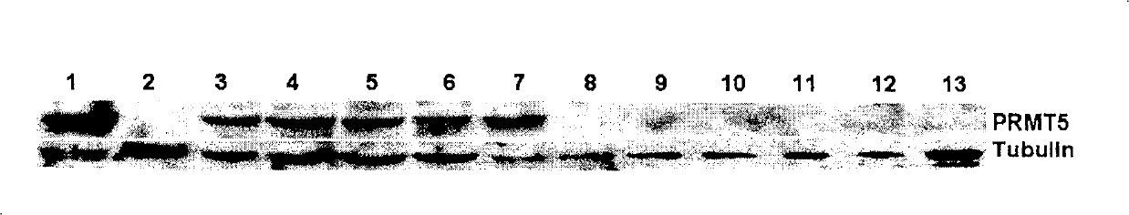 Application of protein arginine methyl transferase 5 in cell detection and treatment of leukemia