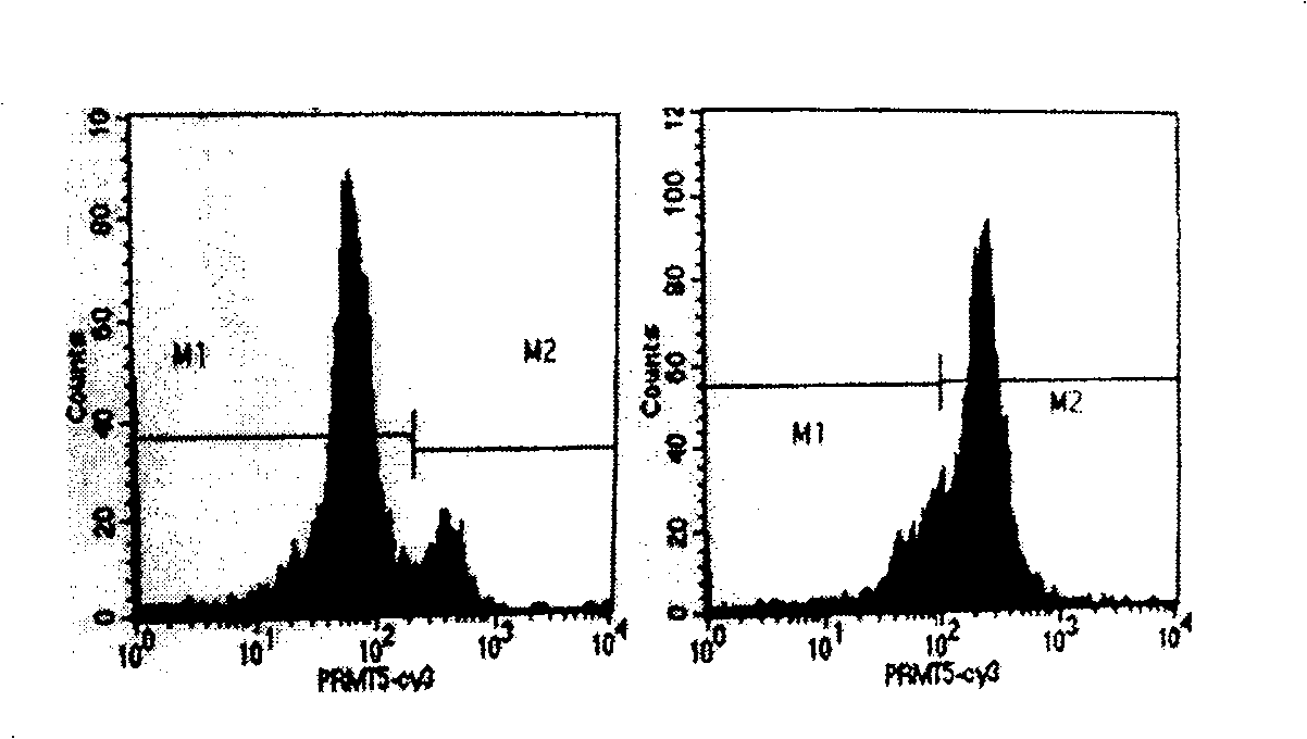 Application of protein arginine methyl transferase 5 in cell detection and treatment of leukemia