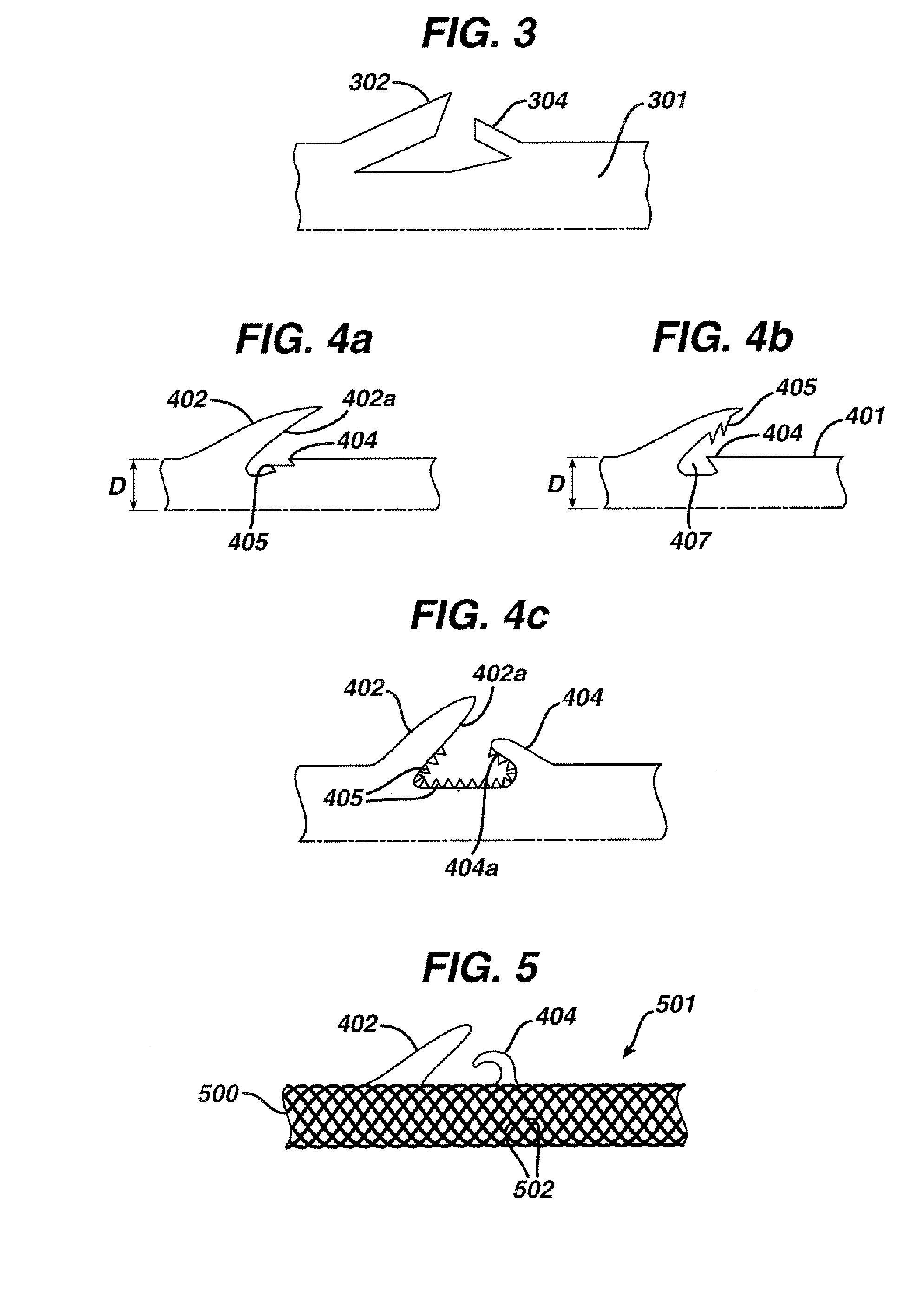 Bi-directional Barbed Suture