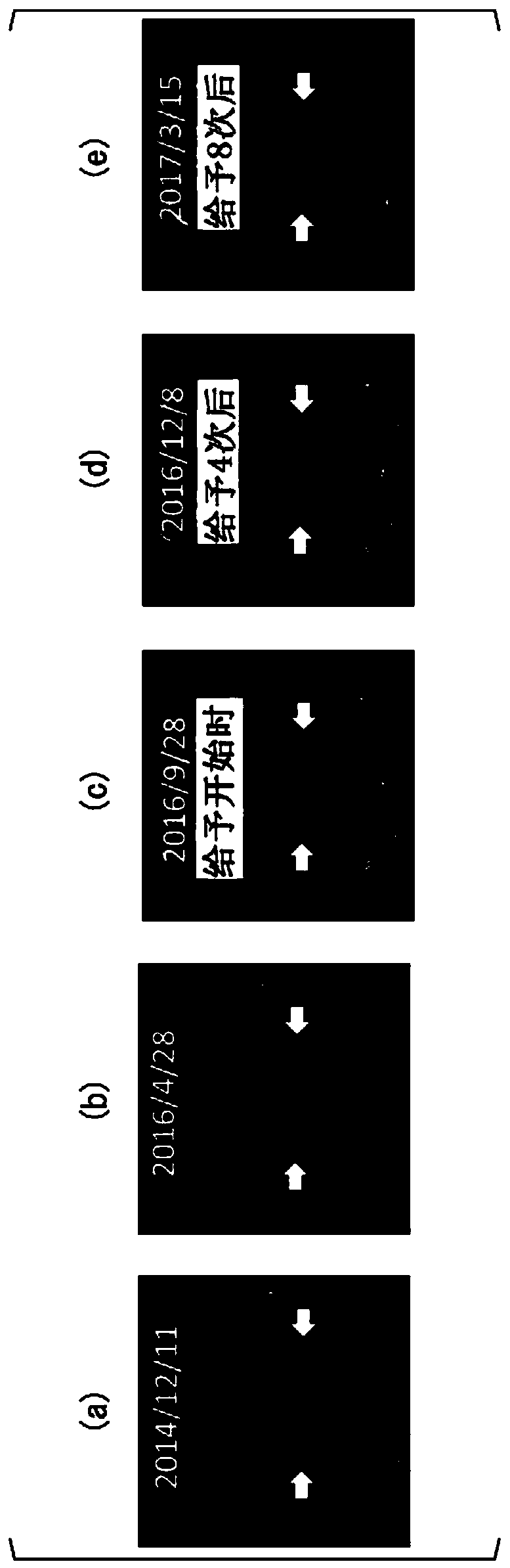 Peptide vaccine and peptide vaccine composition for cranial nerve disease