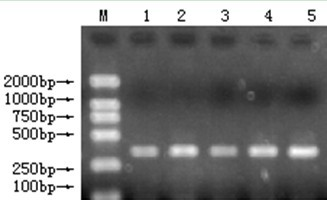 Method for detecting mutation polymorphism of 5 basic groups in gene coding region of goat growth hormone