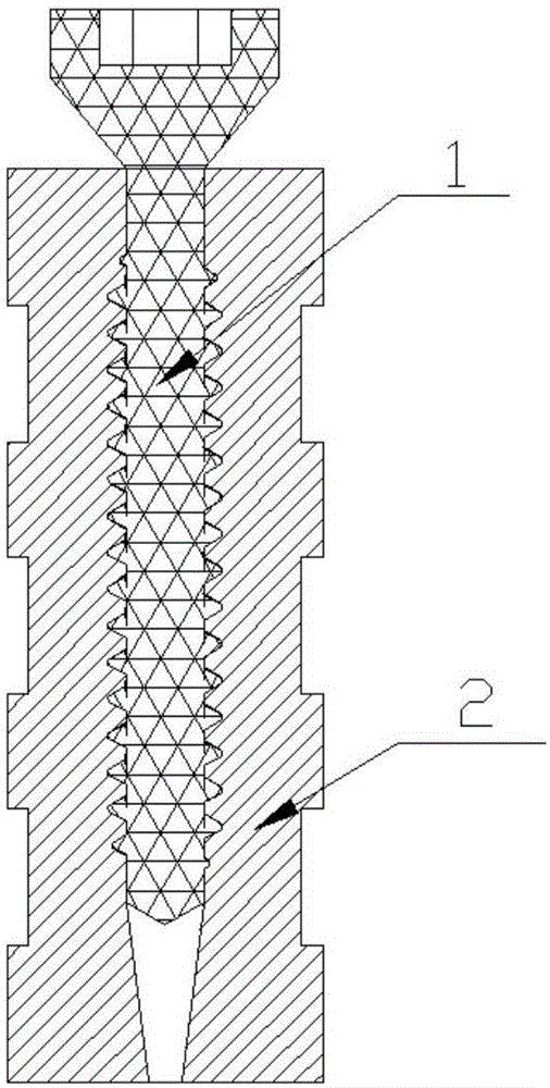 Bone screw covered with soft material