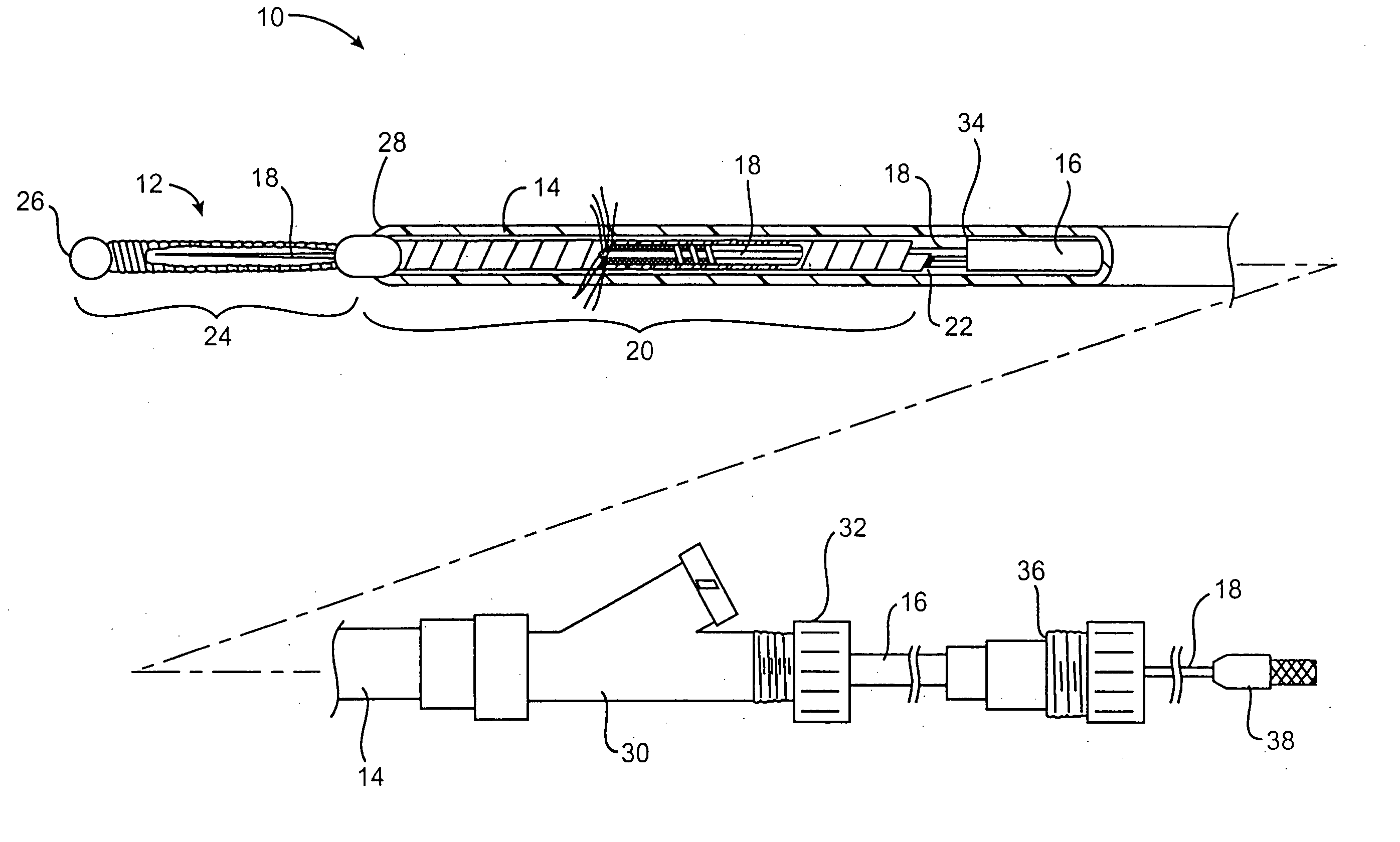 Insertion/deployment catheter system for intrafallopian contraception