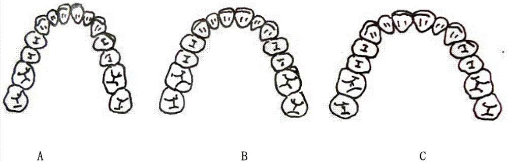 Complete dentition full denture finished product resin tooth and preparation method thereof