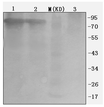 Preparation method of porcine parvovirus genetic engineering vaccine