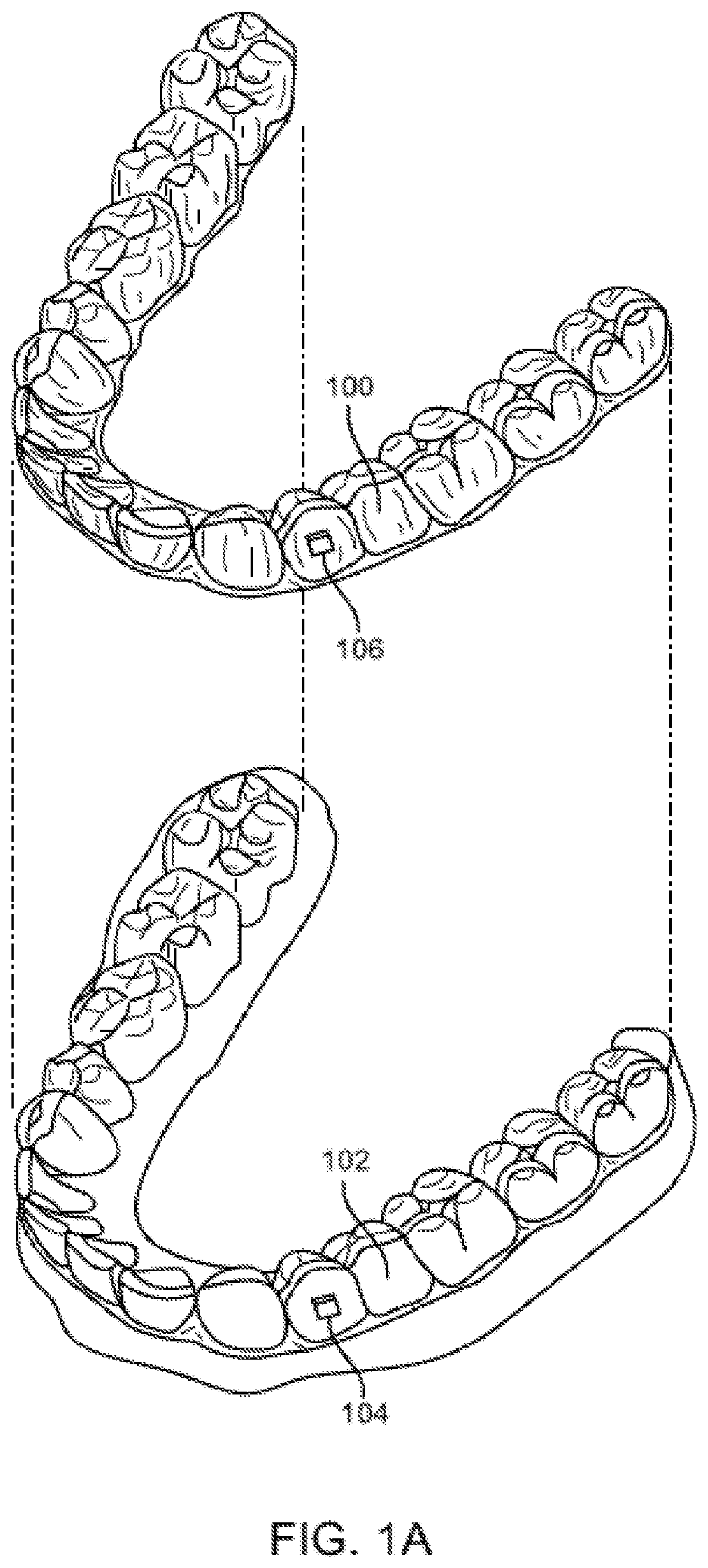 Orthodontic appliance performance monitor