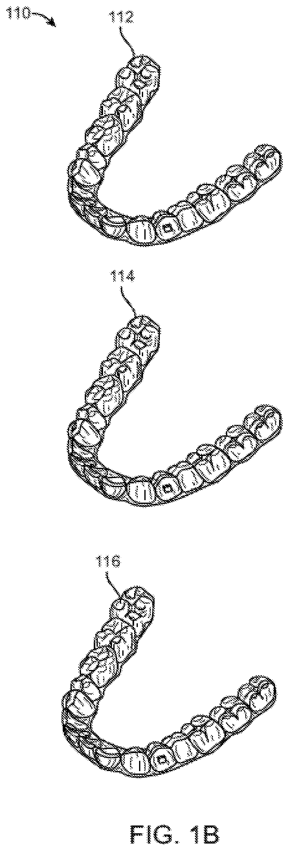 Orthodontic appliance performance monitor