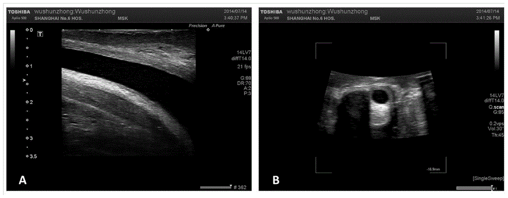 Method for constructing segmental individual human urethral tissue entity model