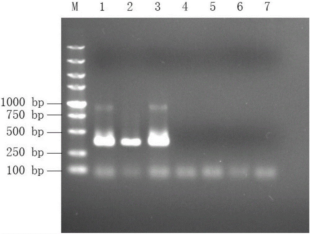 Nested RT-PCR method, primers and reagent kit for detecting Zika virus