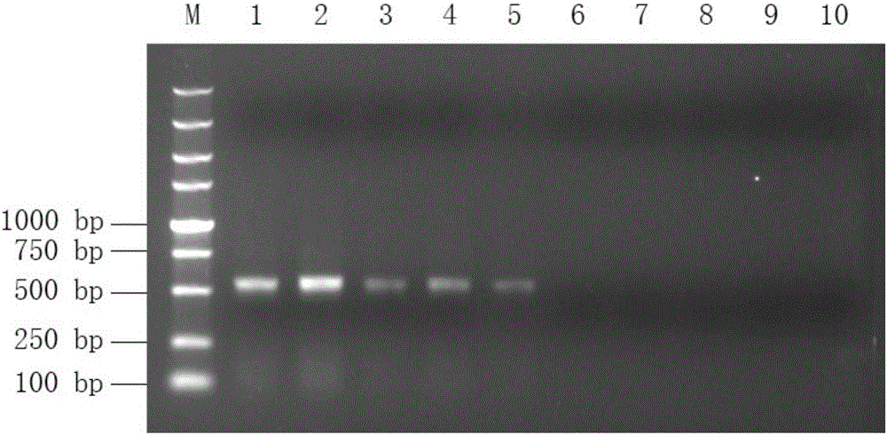 Nested RT-PCR method, primers and reagent kit for detecting Zika virus