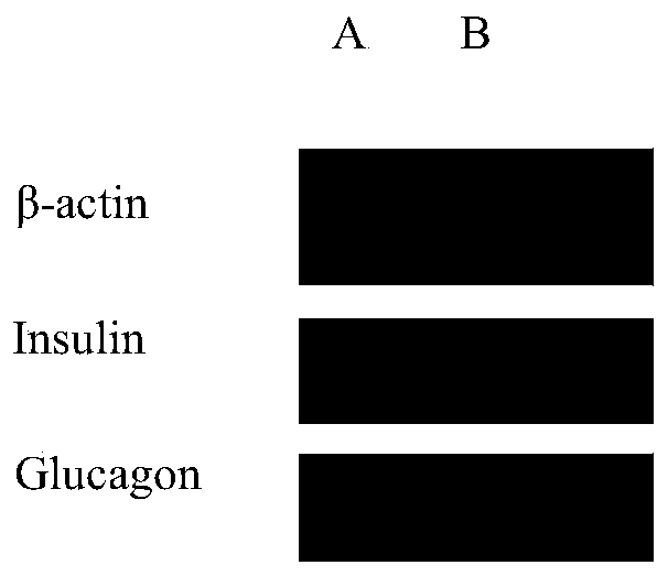 A method for inducing mesenchymal stem cells to differentiate into islet-like cells