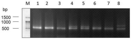 A primer set, kit and method for high-resolution typing of hla-drb1 gene