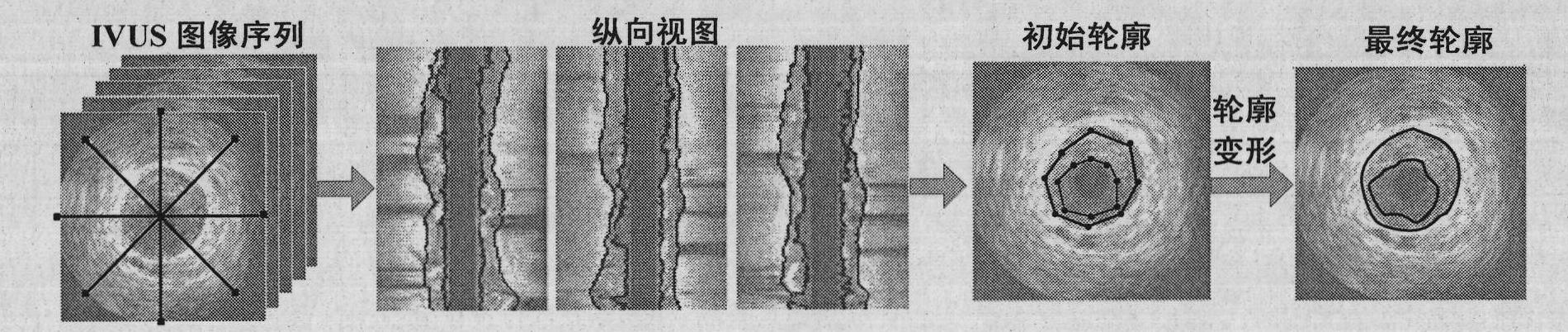 Three-dimensional segmentation method for intravascular ultrasound image sequence