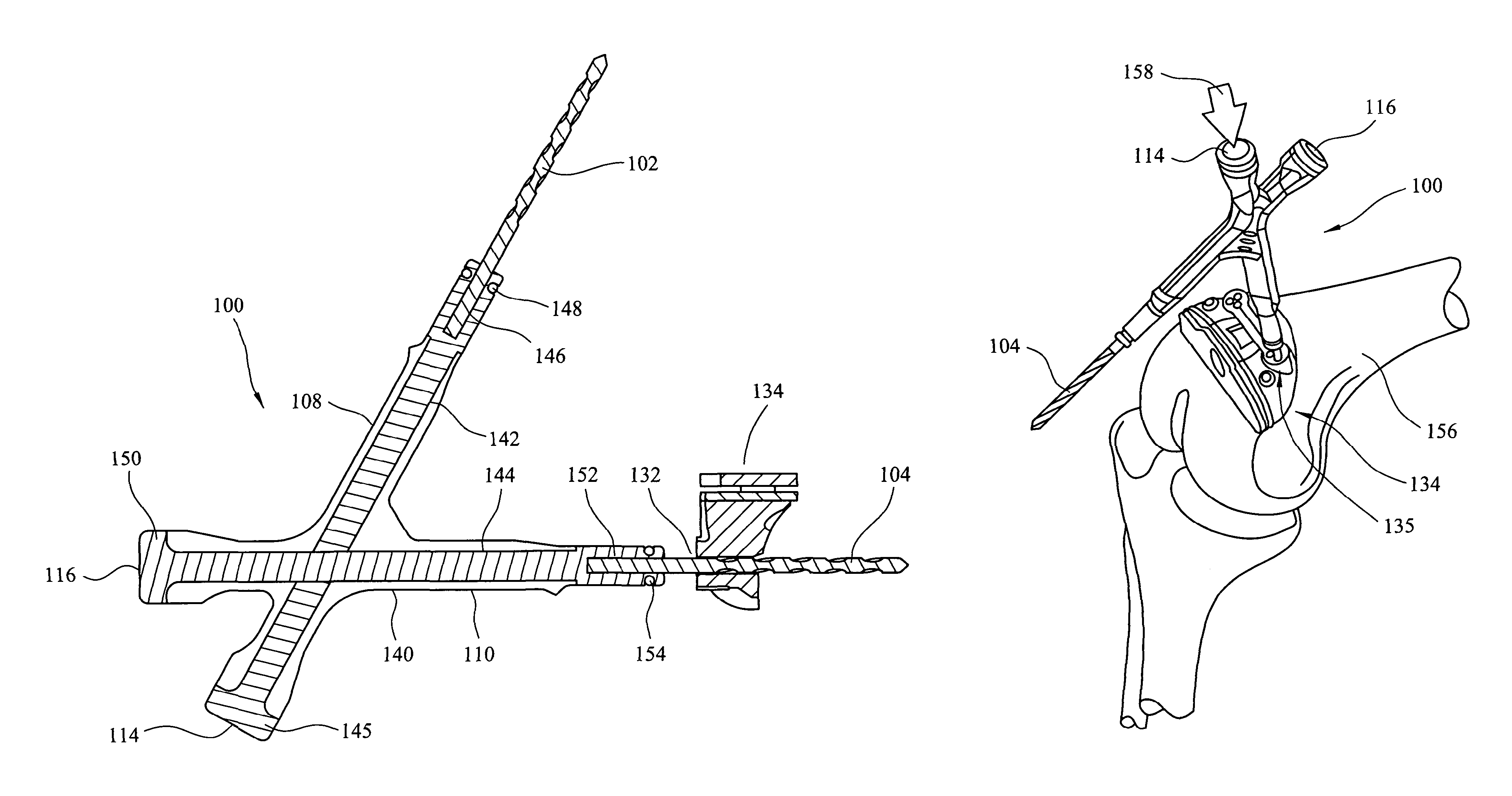 Pin impactor