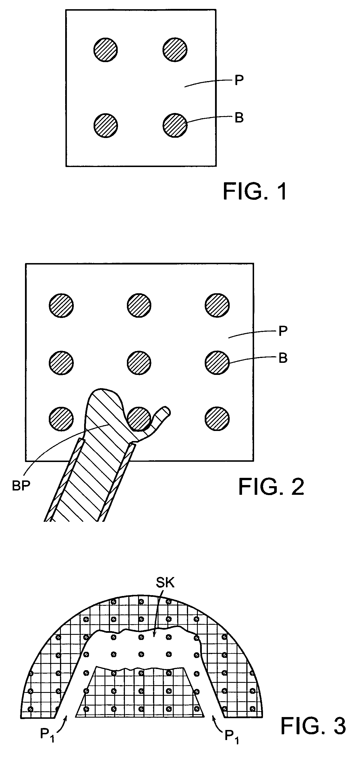 Methods of performing embolism-free vertebroplasty and devices therefor