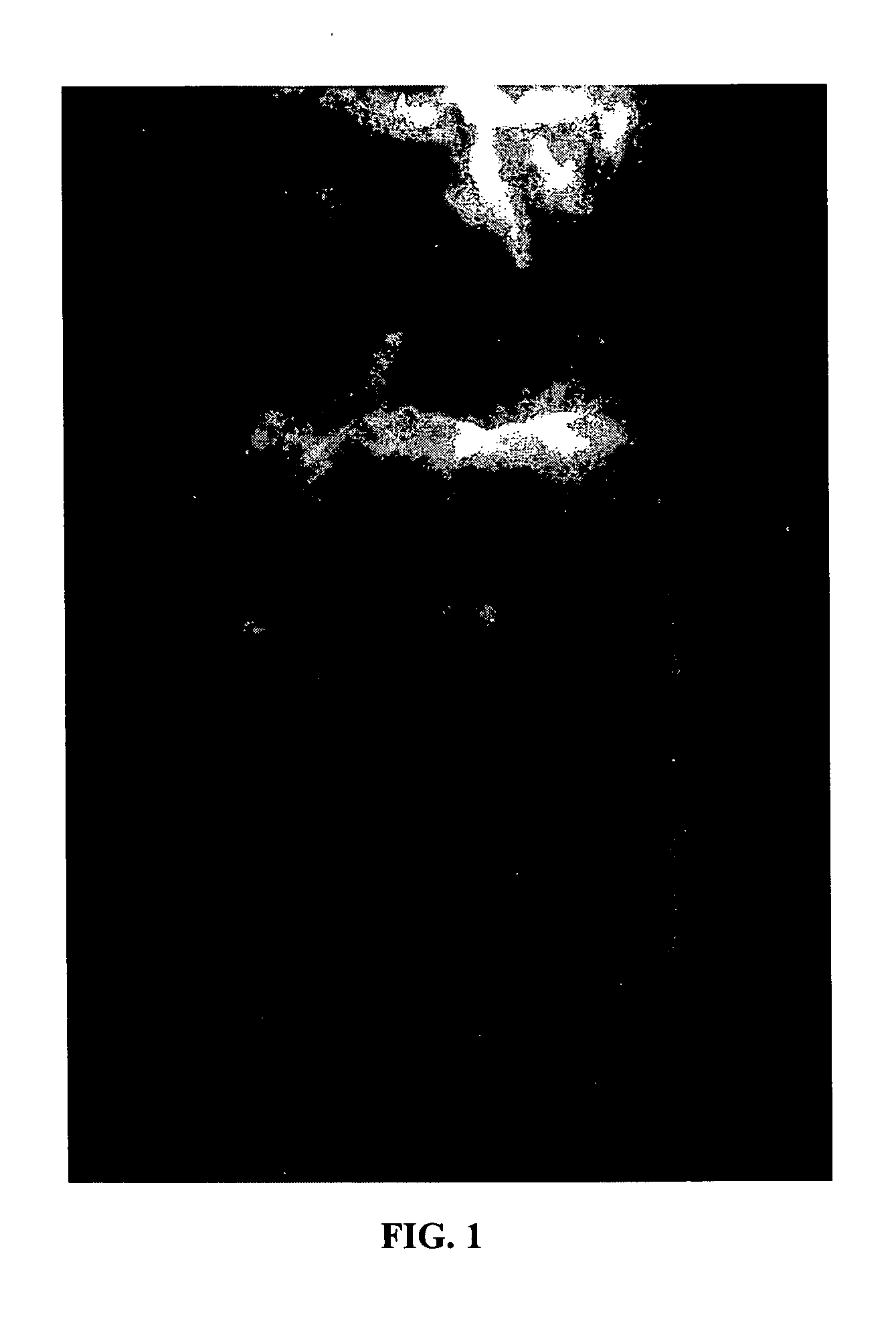 Radio-opaque polymeric biomaterials