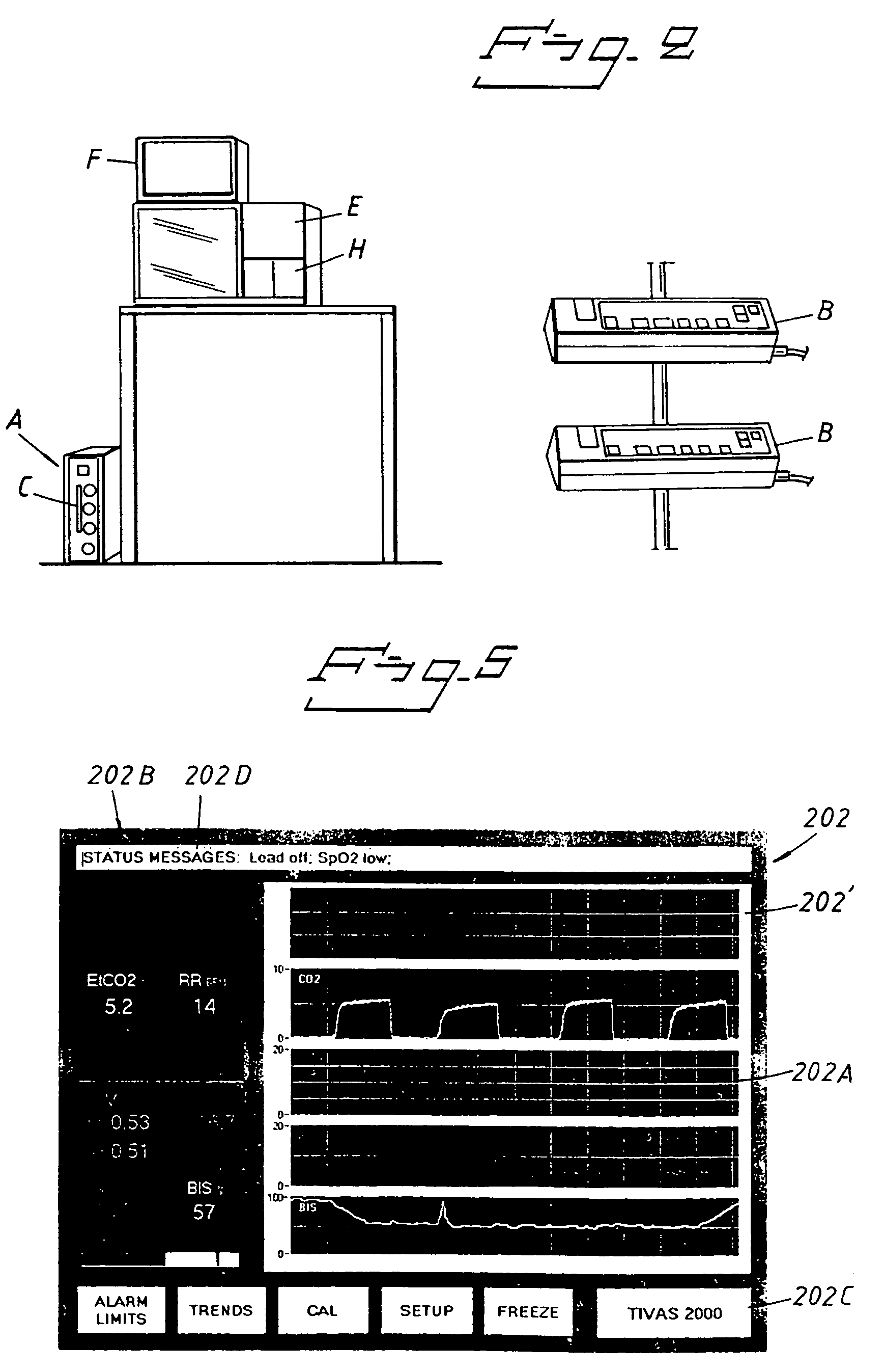 Arrangement for anaesthetising a living creature