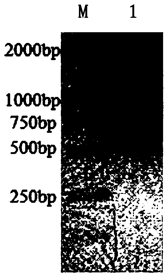 A kind of anti-carcinoembryonic antigen nanobody and its application