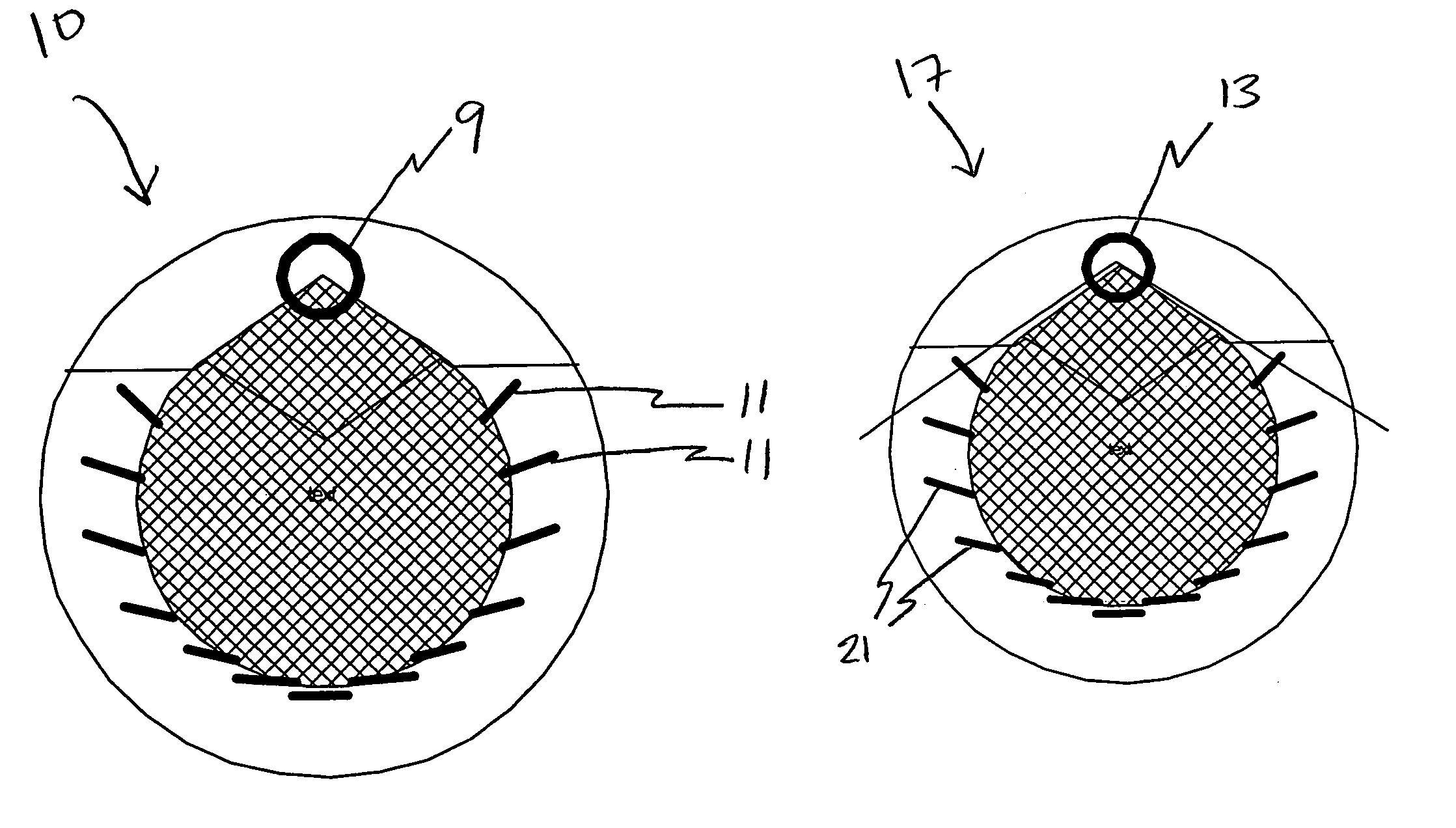 Computed tomography system