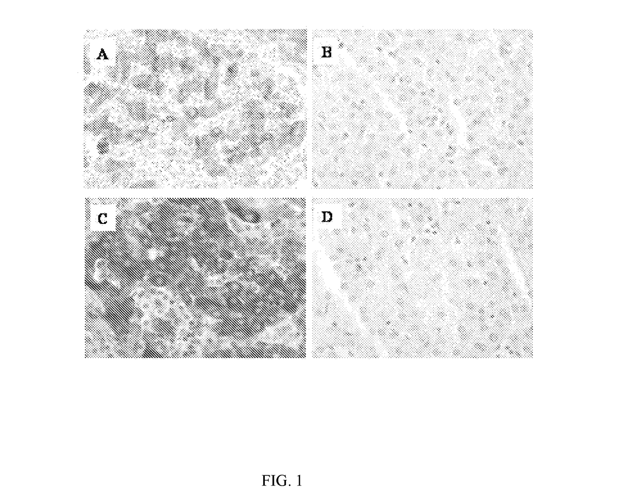 Pharmaceutical composition and pharmaceutical kit for the treatment of hepatocellular carcinoma