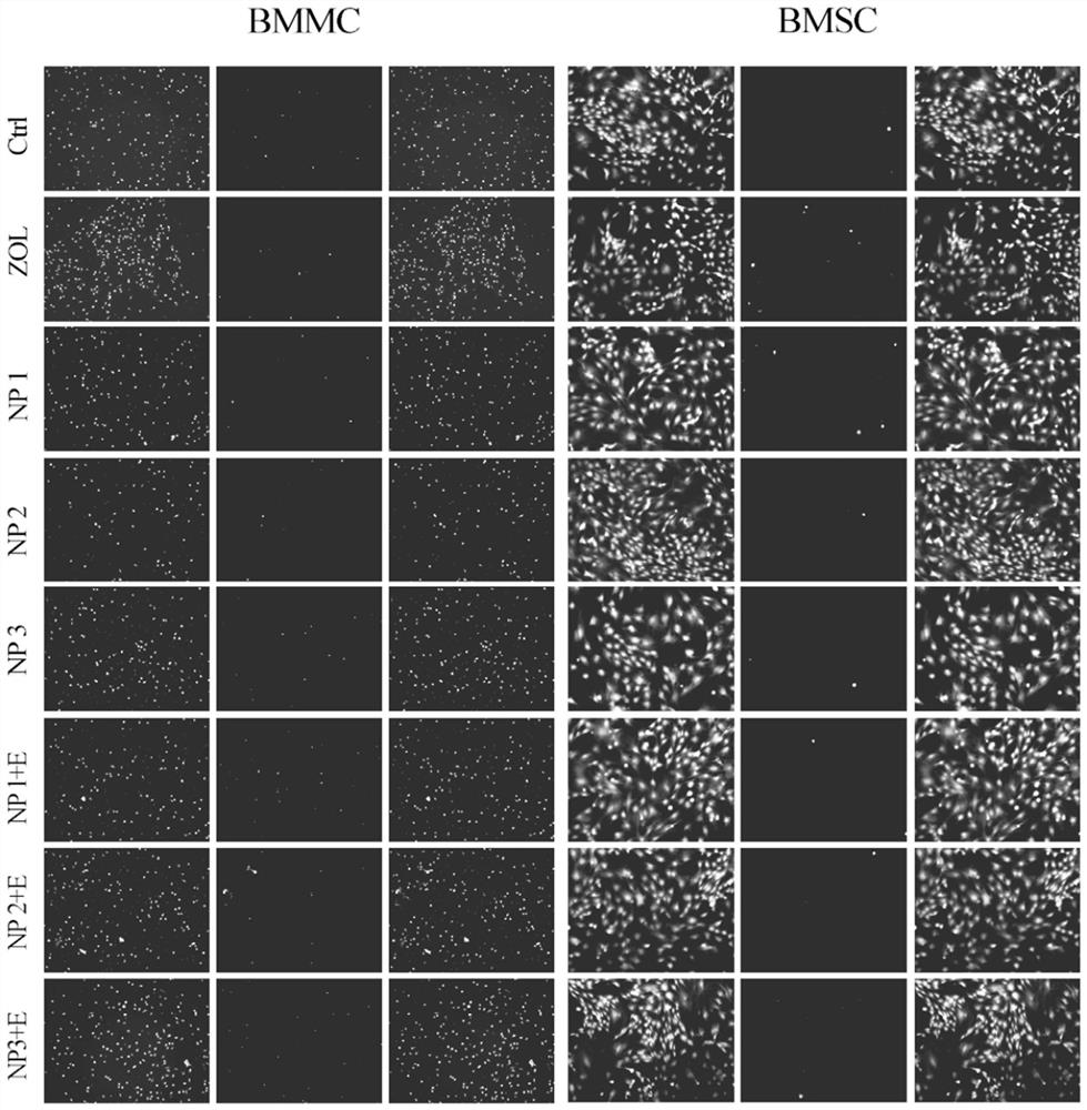 Application of hollow nano-particles in preparation of medicine for treating osteoporosis