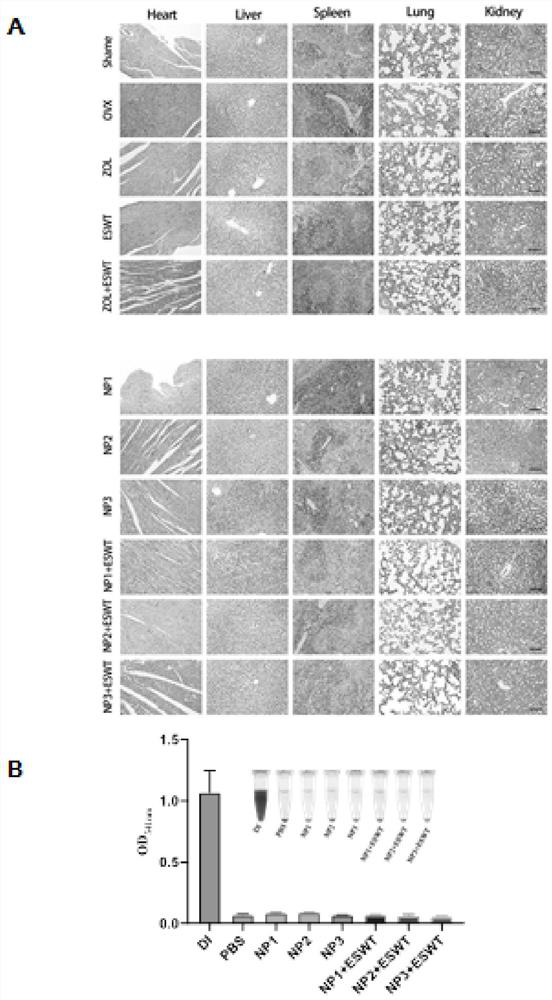 Application of hollow nano-particles in preparation of medicine for treating osteoporosis