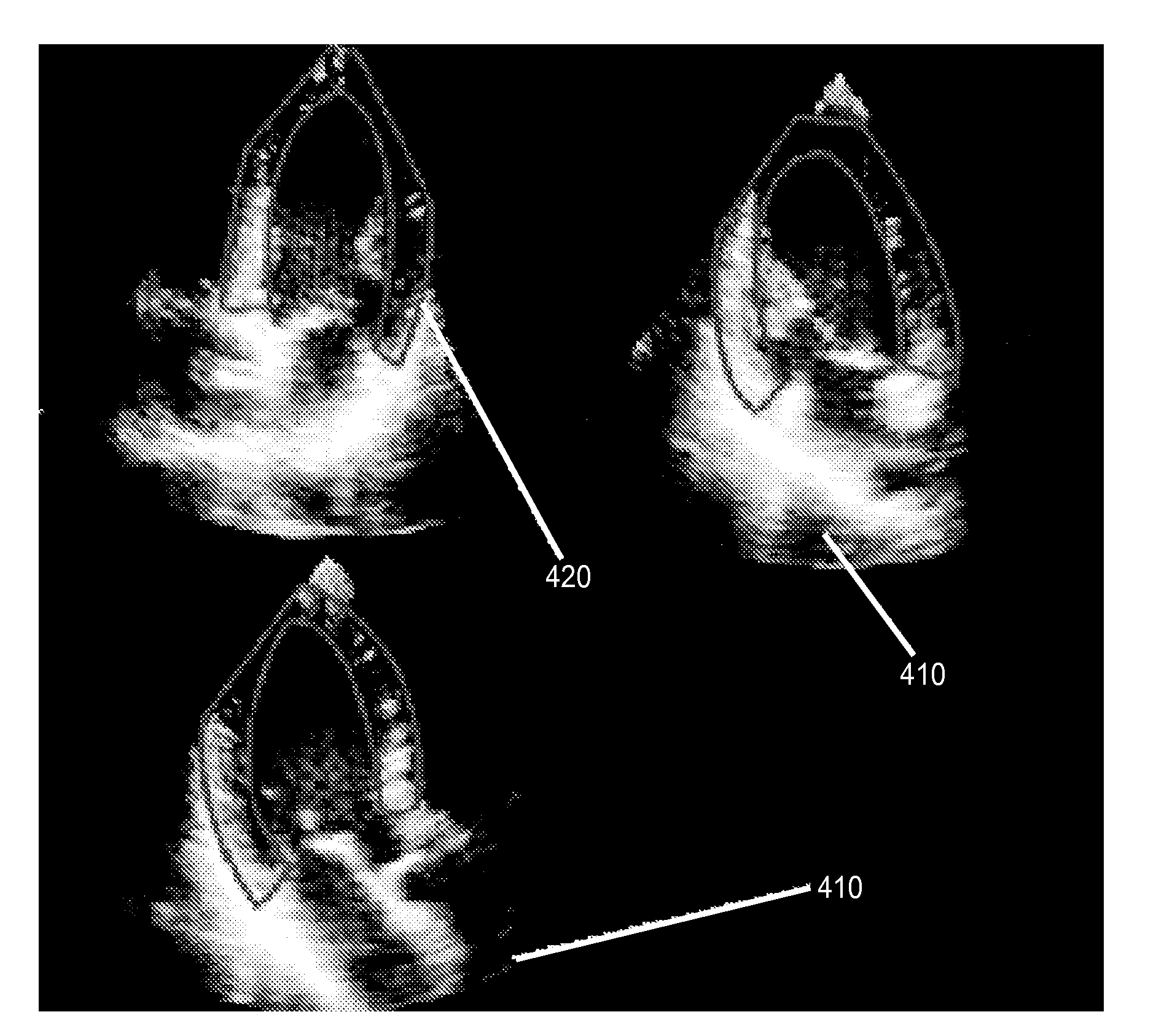 Methods and apparatus for combined 4d presentation of quantitative regional parameters on surface rendering