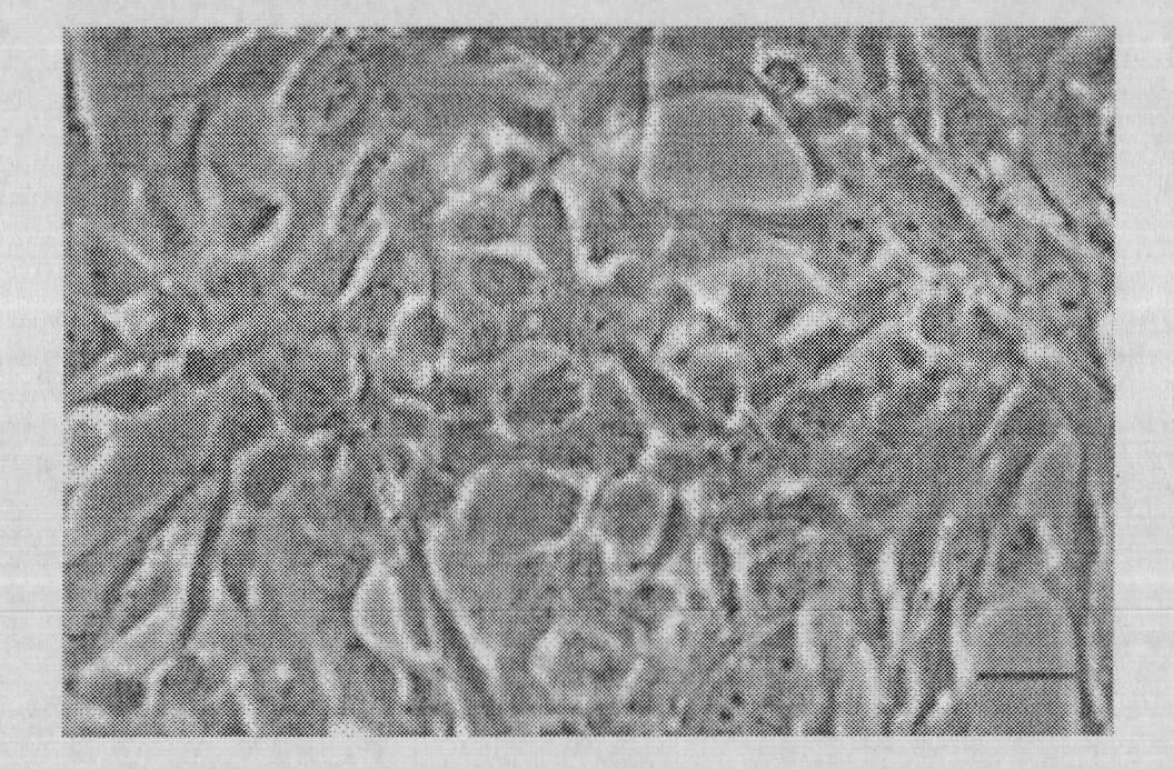 Selective medium of liver stem cells, method for selectively separating and amplifying liver stem cells as well as medicinal composition for treating diabetes