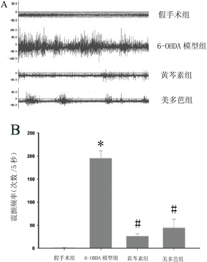 Application of baicalein to preparation of medicament for preventing and treating Parkinson's disease