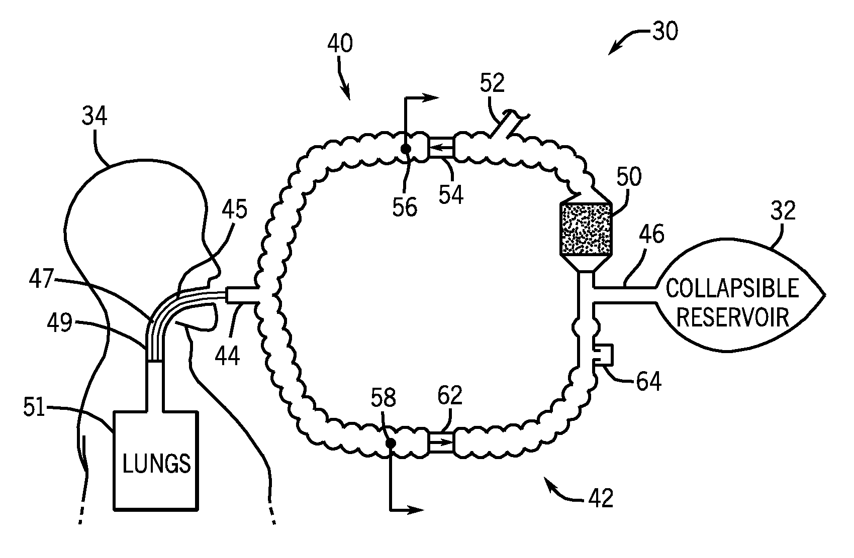 Anesthesia system and method