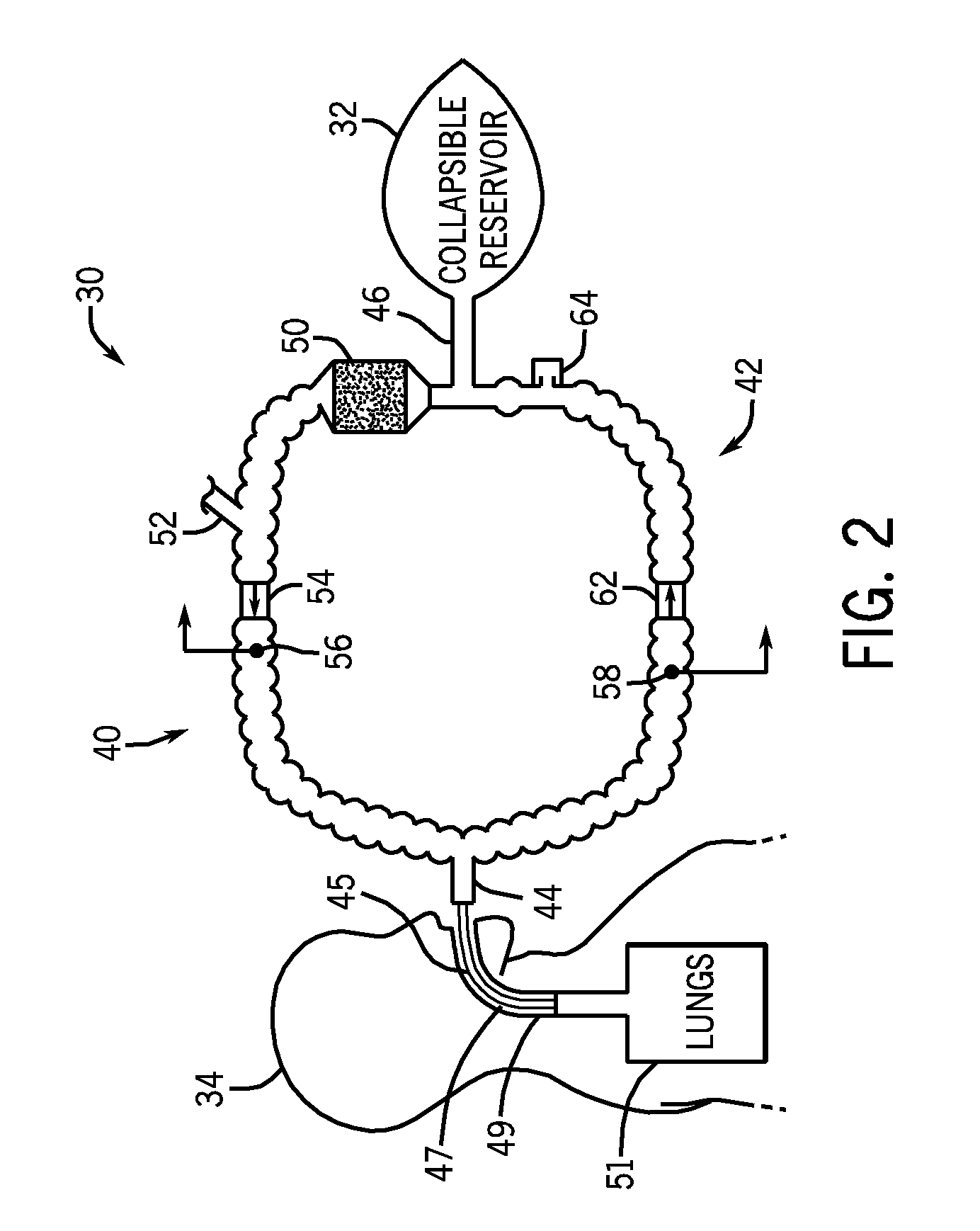 Anesthesia system and method