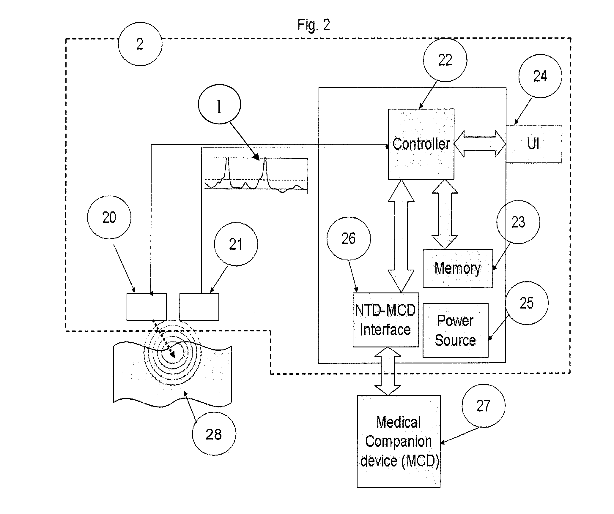 Method And Apparatus For The Detection Of Neural Tissue