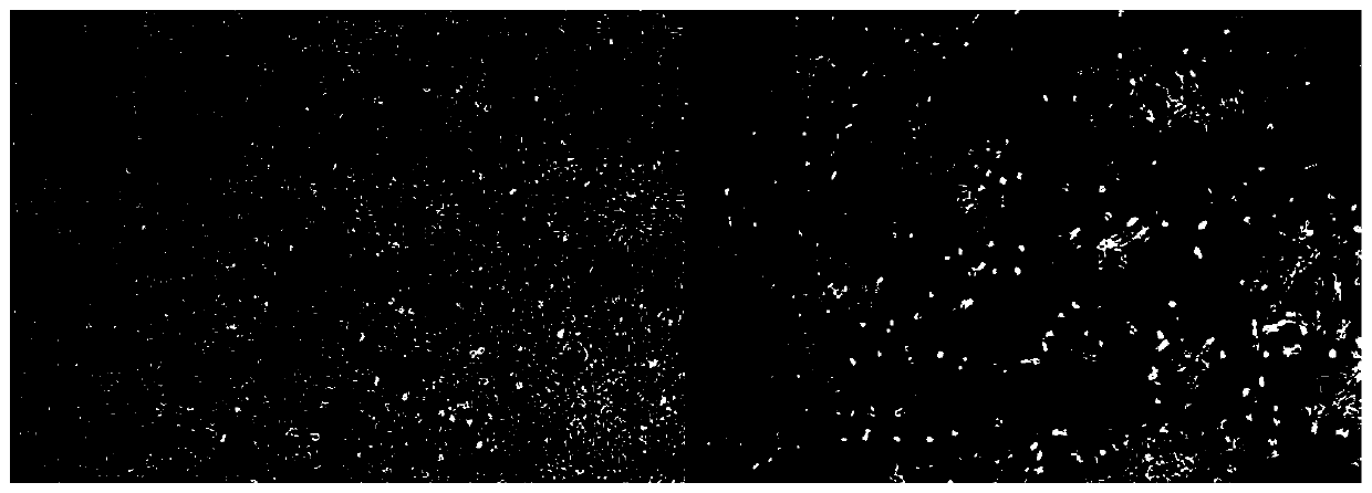 Application of a janus nanoparticle as an adhesive for filling materials in dental restorations